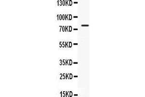 Observed bind size: 80KD (GRP78 Antikörper  (C-Term))