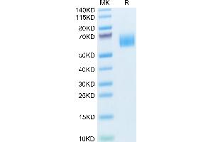 Human TYRO3 on Tris-Bis PAGE under reduced condition. (TYRO3 Protein (AA 41-429) (His tag))