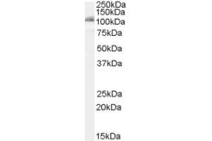 Image no. 1 for anti-Insulin-Degrading Enzyme (IDE) (Internal Region) antibody (ABIN375106) (IDE Antikörper  (Internal Region))