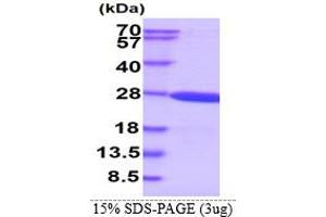 SDS-PAGE (SDS) image for Crystallin, gamma S (CRYGS) (AA 1-178) protein (His tag) (ABIN667553)