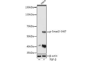 Western blot analysis of extracts of HeLa cells, using Phospho-Smad2-S467 antibody (ABIN3019982, ABIN3019983, ABIN3019984 and ABIN1682048) at 1:1000 dilution. (SMAD2 Antikörper  (pSer467))