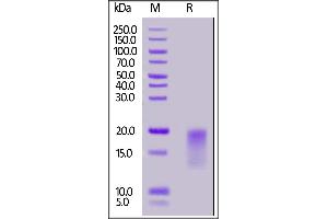 SDS-PAGE (SDS) image for Tumor Necrosis Factor Receptor Superfamily, Member 13C (TNFRSF13C) (AA 7-71) (Active) protein (His tag) (ABIN7013842)