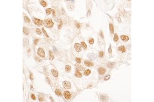 anti-Peptidylprolyl Isomerase G (Cyclophilin G) (PPIG) (AA 375-325) antibody
