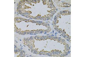 Immunohistochemistry of paraffin-embedded human prostate using DBI Antibody. (Diazepam Binding Inhibitor Antikörper)