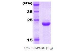 SDS-PAGE (SDS) image for Killer Cell Immunoglobulin-Like Receptor, Two Domains, Long Cytoplasmic Tail, 3 (KIR2DL3) (AA 1-202) protein (ABIN666834)