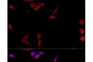 Immunofluorescence analysis of NIH/3T3 cells using CD40L Polyclonal Antibody at dilution of 1:100. (CD40 Ligand Antikörper)