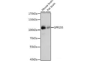 Western blot analysis of extracts of various cell lines using GPR155 Polyclonal Antibody at dilution of 1:1000. (GPR155 Antikörper)