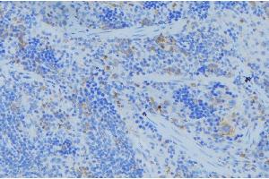 ABIN6273685 at 1/100 staining Human lymph node tissue by IHC-P. (Keratin 77 Antikörper  (Internal Region))