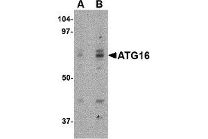 Western Blotting (WB) image for anti-ATG16 Autophagy Related 16-Like 1 (ATG16L1) (Middle Region) antibody (ABIN1030869) (ATG16L1 Antikörper  (Middle Region))
