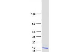 Western Blotting (WB) image for Cystatin E/M (CST6) protein (Myc-DYKDDDDK Tag) (ABIN2712798)