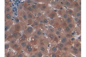 DAB staining on IHC-P; Samples: Human Liver Tissue (CTNNBIP1 Antikörper  (AA 1-81))