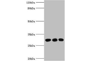 Western blot All lanes: CA1 antibody at 6 μg/mL Lane 1: Jurkat whole cell lysate Lane 2: K562 whole cell lysate Lane 3: Mouse spleen tissue Secondary Goat polyclonal to rabbit IgG at 1/10000 dilution Predicted band size: 29 kDa Observed band size: 29 kDa (CA1 Antikörper  (AA 1-261))