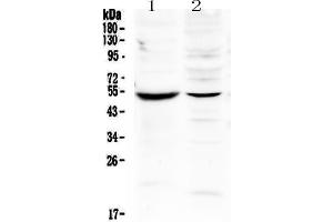 Western blot analysis of MMP16 using anti-MMP16 antibody . (MMP16 Antikörper  (AA 120-296))