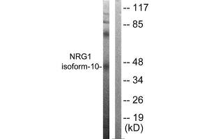 Western Blotting (WB) image for anti-Neuregulin 1 (NRG1) (Isoform 10), (N-Term) antibody (ABIN1848606) (Neuregulin 1 Antikörper  (Isoform 10, N-Term))