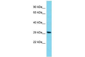 Host: Rabbit Target Name: C14orf105 Sample Type: HCT15 Whole Cell lysates Antibody Dilution: 1. (C14ORF105 Antikörper  (C-Term))