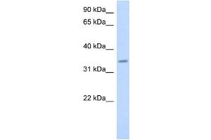 WB Suggested Anti-PAQR6 Antibody Titration:  0. (PAQR6 Antikörper  (Middle Region))