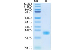 Cynomolgus IL-11 on Tris-Bis PAGE under reduced condition. (IL-11 Protein (AA 22-199) (His tag))