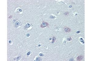 TRPM2 Antikörper  (AA 431-480)