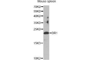 Western blot analysis of extracts of mouse spleen, using DR1 antibody. (DR1 Antikörper)