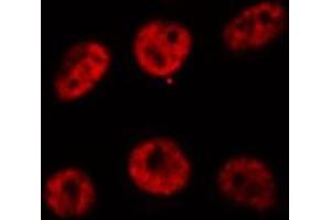 ABIN6269310 staining HeLa cells by IF/ICC. (RUNX1 Antikörper  (Internal Region))