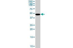 SMARCB1 monoclonal antibody (M01), clone 3E10. (SMARCB1 Antikörper  (AA 81-180))