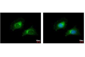 ICC/IF Image CARD6 antibody [N1N2], N-term detects CARD6 protein at cytoplasm by immunofluorescent analysis.
