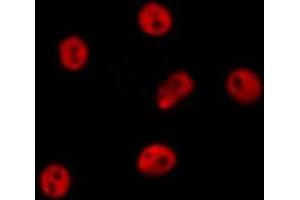 ABIN6277531 staining  RAW264. (GTF2A1 Antikörper  (Internal Region))