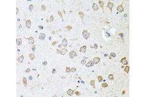 Immunohistochemistry of paraffin-embedded Mouse brain using AKAP5 Polyclonal Antibody at dilution of 1:100 (40x lens). (AKAP5 Antikörper)