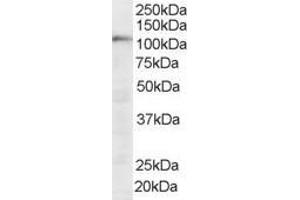 Western Blotting (WB) image for anti-Squamous Cell Carcinoma Antigen Recognized By T Cells (SART1) (N-Term) antibody (ABIN2466239) (SART1 Antikörper  (N-Term))
