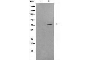 Western blot analysis on COLO205 cell lysate using STEA3 Antibody,The lane on the left is treated with the antigen-specific peptide. (STEAP3 Antikörper  (N-Term))