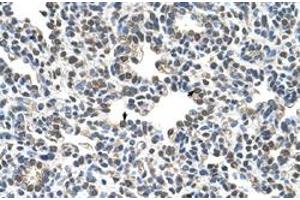 Immunohistochemical staining (Formalin-fixed paraffin-embedded sections) of human lung with CIZ1 polyclonal antibody  at 4-8 ug/mL working concentration. (CIZ1 Antikörper  (C-Term))