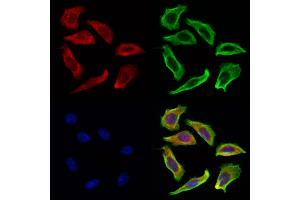 ABIN6263424 and ABIN6269252 staining Hela cells by IF/ICC. (MTOR Antikörper  (C-Term))