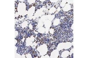 Immunohistochemical staining of human bone marrow with SPIN3 polyclonal antibody  shows strong nuclear and cytoplasmic positivity in bone marrow poietic cells. (SPIN3 Antikörper)