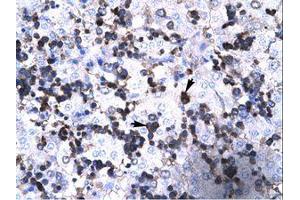 Image no. 1 for anti-Forkhead Box P3 (FOXP3) (AA 100-149) antibody (ABIN202505) (FOXP3 Antikörper  (AA 100-149))