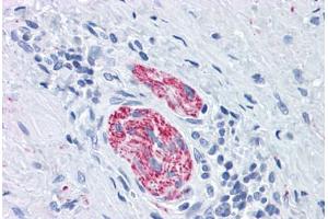 Human Nerve: Formalin-Fixed, Paraffin-Embedded (FFPE) (MAPT Antikörper  (Ser404))