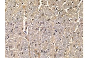 ABIN6258224 and ABIN6275160 at 1/100 staining rat brain tissue by IHC-P.
