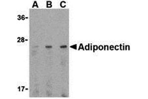 Western Blotting (WB) image for anti-Adiponectin (ADIPOQ) (C-Term) antibody (ABIN1030223) (ADIPOQ Antikörper  (C-Term))