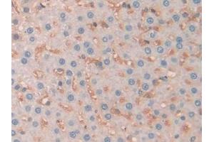 Detection of SERPINA10 in Rat Liver Tissue using Polyclonal Antibody to Serpin A10 (SERPINA10) (SERPINA10 Antikörper  (AA 278-425))
