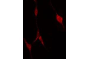 ABIN6274311 staining A549 cells by IF/ICC. (PFKP Antikörper  (Internal Region))