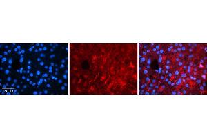 Rabbit Anti-RARA Antibody    Formalin Fixed Paraffin Embedded Tissue: Human Adult liver  Observed Staining: Cytoplasmic (abundant), Nuclear (very rare) Primary Antibody Concentration: 1:100 Secondary Antibody: Donkey anti-Rabbit-Cy2/3 Secondary Antibody Concentration: 1:200 Magnification: 20X Exposure Time: 0. (Retinoic Acid Receptor alpha Antikörper  (Middle Region))