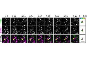TrkB binds to BDNF at the plasma membrane. (BDNF Protein (Biotin))