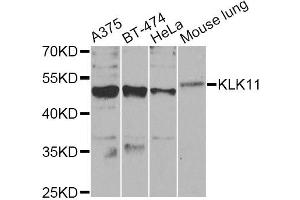 Western blot analysis of extracts of various cell lines, using KLK11 Antibody (ABIN5975048) at 1/1000 dilution. (Kallikrein 11 Antikörper)