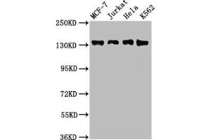 Western Blot Positive WB detected in: MCF-7 whole cell lysate, Jurkat whole cell lysate, Hela whole cell lysate, K562 whole cell lysate All lanes: WAPL antibody at 2. (WAPAL Antikörper  (AA 1037-1190))