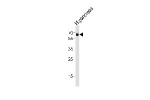 Western blot analysis of lysate from human pancreas tissue lysate, using ACVR2B Antibody (S14) A. (ACVR2B Antikörper  (AA 1-30))