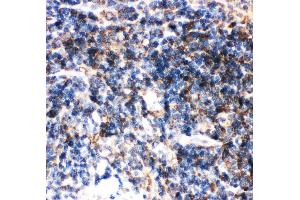 Immunohistochemistry (IHC) image for anti-BH3 Interacting Domain Death Agonist (BID) (AA 1-195) antibody (ABIN3042321)