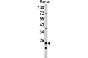 Western Blotting (WB) image for anti-Ribosomal Protein S9 (RPS9) antibody (ABIN3002715) (RPS9 Antikörper)