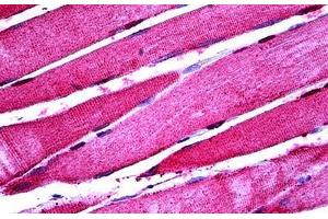 Human Skeletal Muscle: Formalin-Fixed, Paraffin-Embedded (FFPE) (ENO3 Antikörper  (AA 228-278))