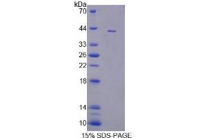 SDS-PAGE (SDS) image for Dynamin 3 (DNM3) (AA 1-323) protein (His tag) (ABIN6239439)