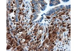 Immunohistochemical staining of paraffin-embedded Kidney tissue using anti-RC219453 mouse monoclonal antibody. (NPR3 Antikörper)