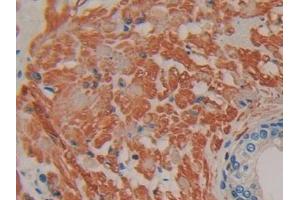 DAB staining on IHC-P; Samples: Human Prostate Tissue (IFNA7 Antikörper  (AA 24-189))